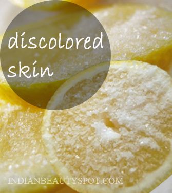 Whitening Skin with Lemons