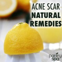 How to Eliminate Acne Scars
