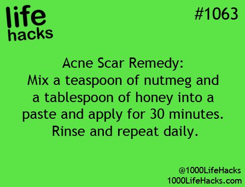 How to Eliminate Acne Scars How to Eliminate Acne Scars