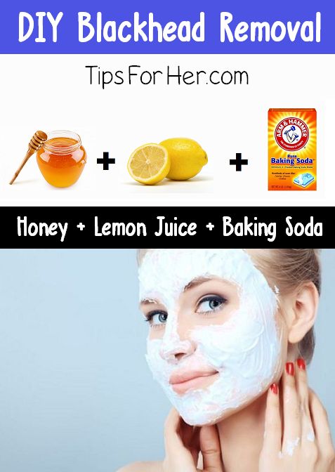 DIY Blackhead Removal