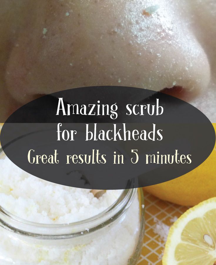 Scrub for Blackheads