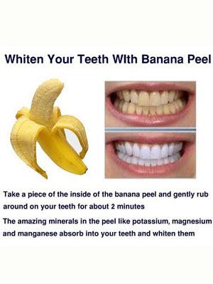 7 Ways to Whiten Your Teeth At Home
