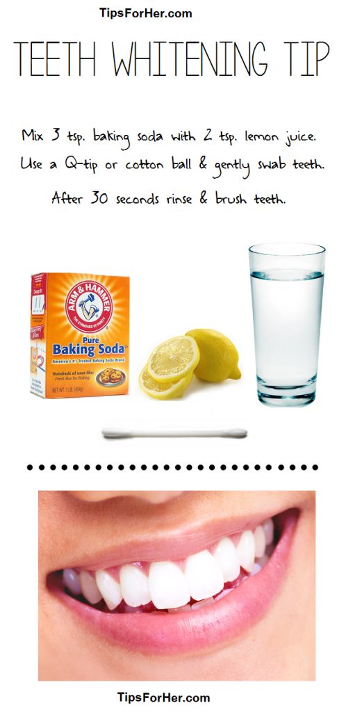 7 Ways to Whiten Your Teeth At Home