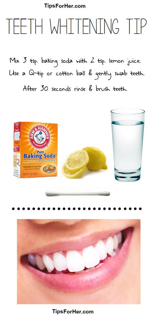 7 Ways to Whiten Your Teeth At Home
