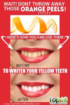 7 Ways to Whiten Your Teeth At Home