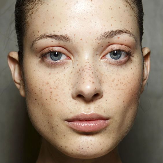 How to Draw On Freckles That Don't Look Fake