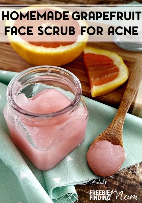 7 Skincare Tips For Acne-Prone Skin