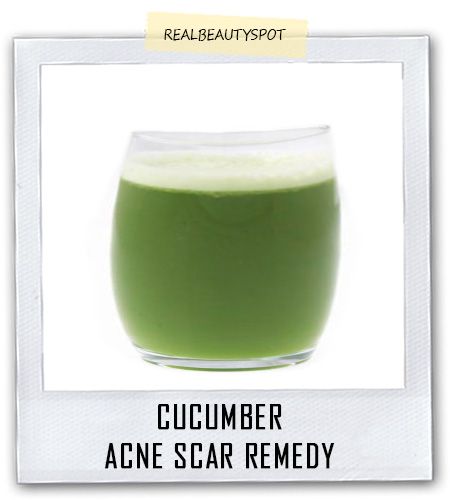 How to Eliminate Acne Scars